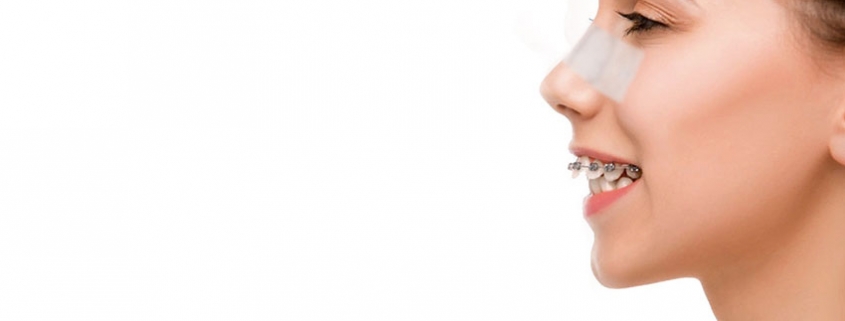ارتودنسی و جراحی بینی
