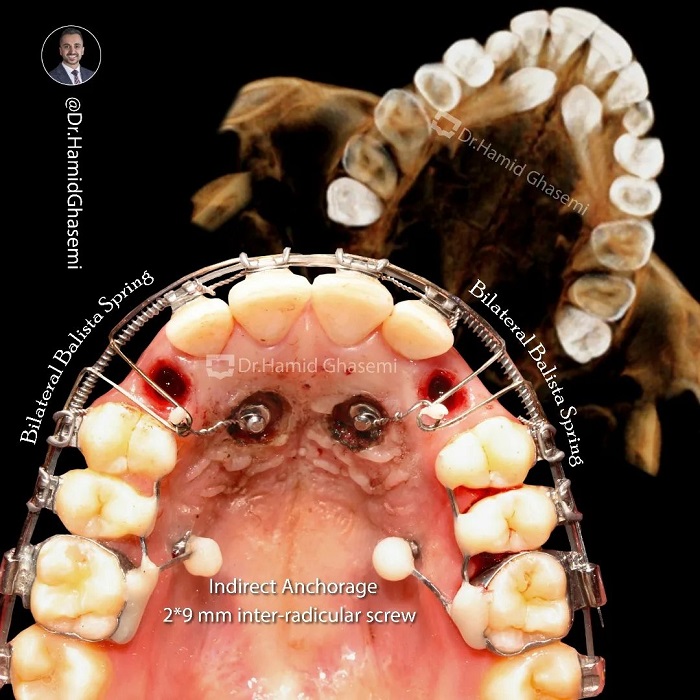 نمونه درمان ارتودنسی M.00_1898