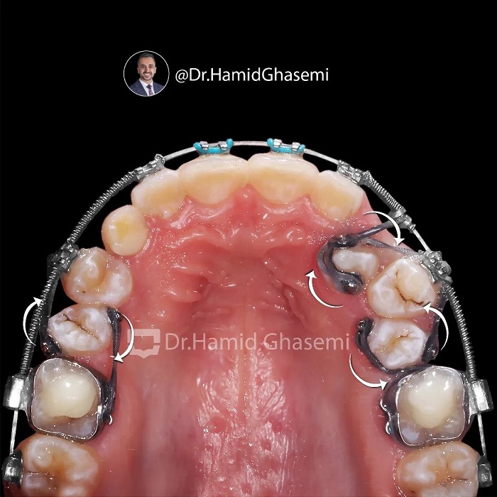 نمونه درمان ارتودنسی M.00_2006
