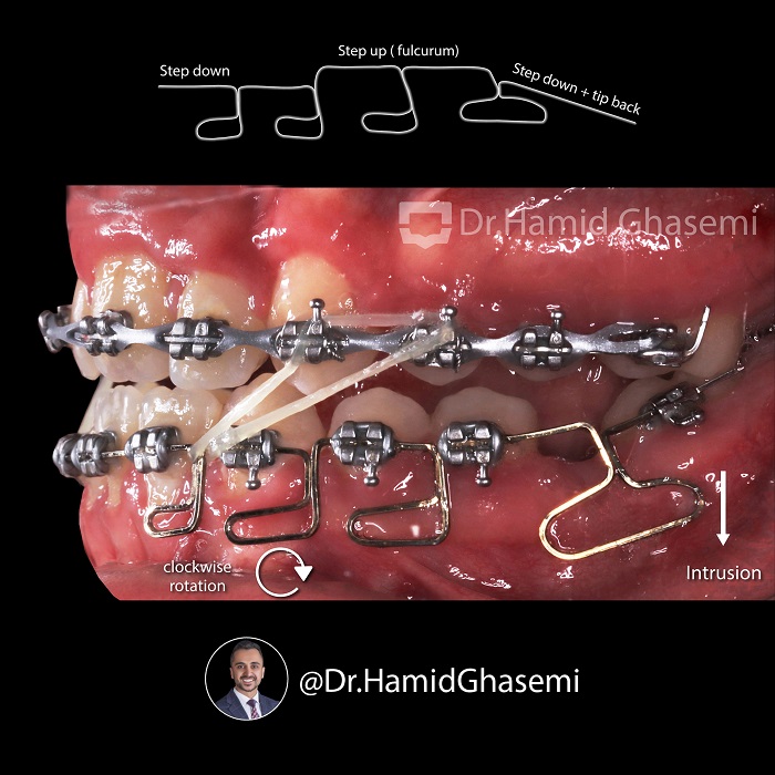 نمونه درمان ارتودنسی M.97_1376