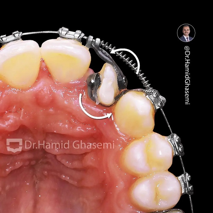 نمونه درمان ارتودنسی M. 98_1519