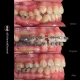 نمونه درمان ارتودنسی M.98_1542