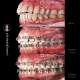 نمونه درمان ارتودنسی M.00_1883