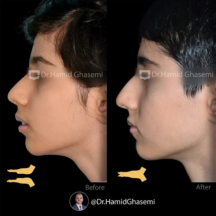 2المیرا بصیری