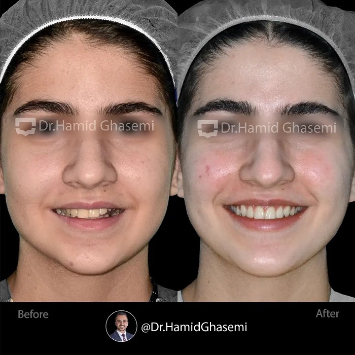 2شقایق حسینی