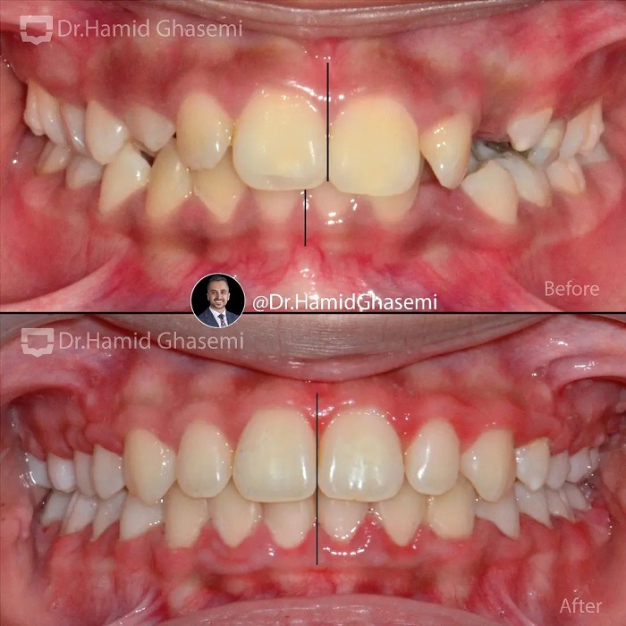 3المیرا بصیری