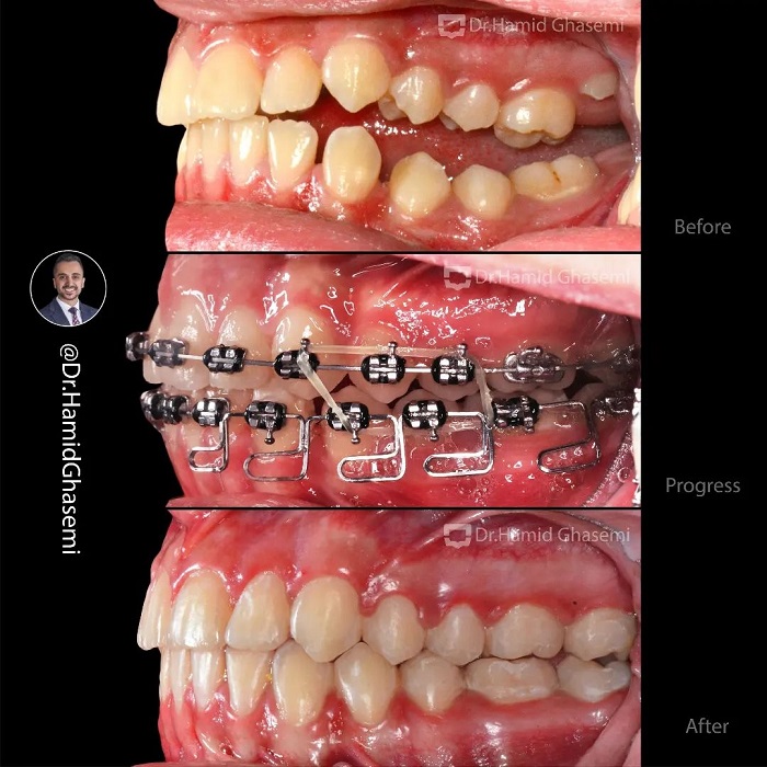 3شقایق حسینی