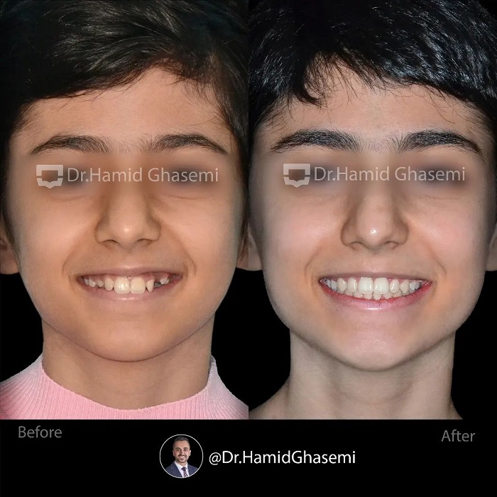 4المیرا بصیری