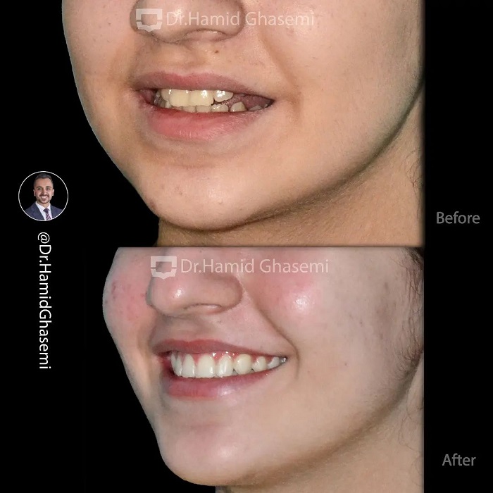 4شقایق حسینی