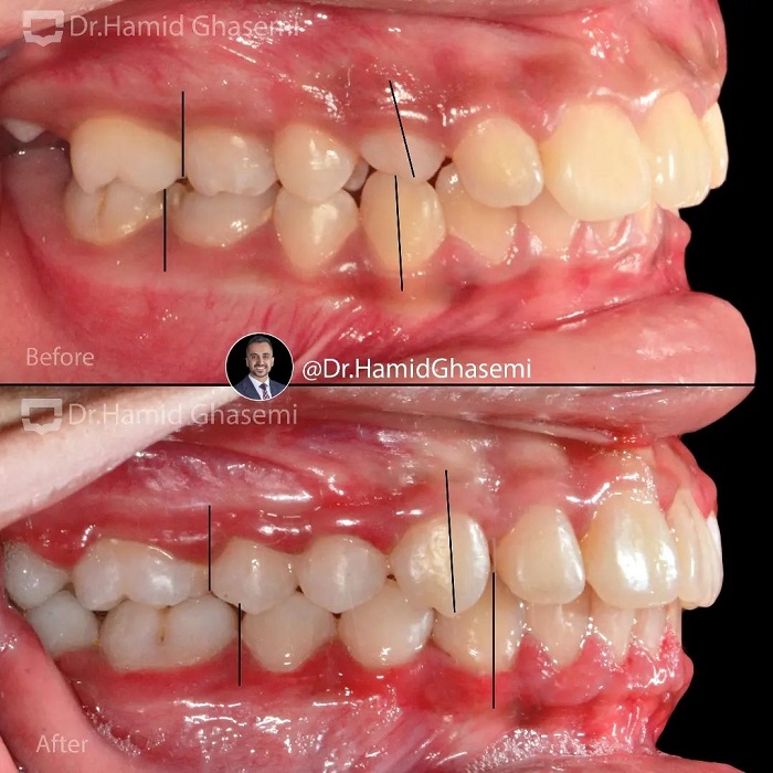 5المیرا بصیری