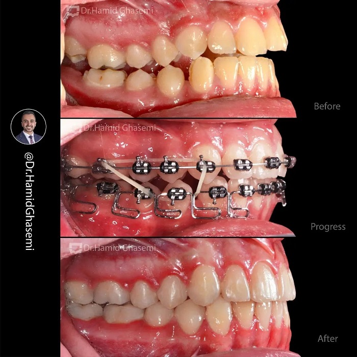 5شقایق حسینی
