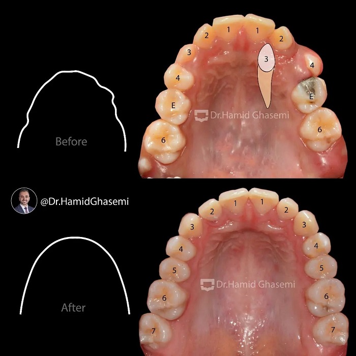6المیرا بصیری