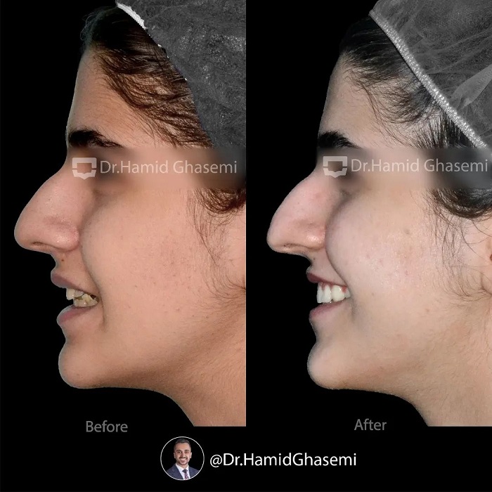 6شقایق حسینی