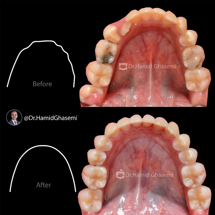 7المیرا بصیری