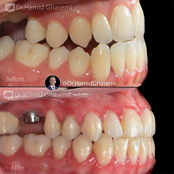 آزاده-خیرخواه-1