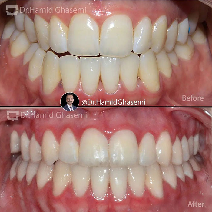 آزاده-خیرخواه-3