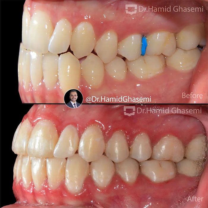 آزاده-خیرخواه-4