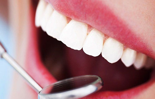 انواع ناهنجاری های دندان