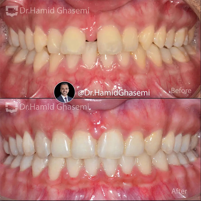 نمونه درمان ارتودنسی M.97_1363