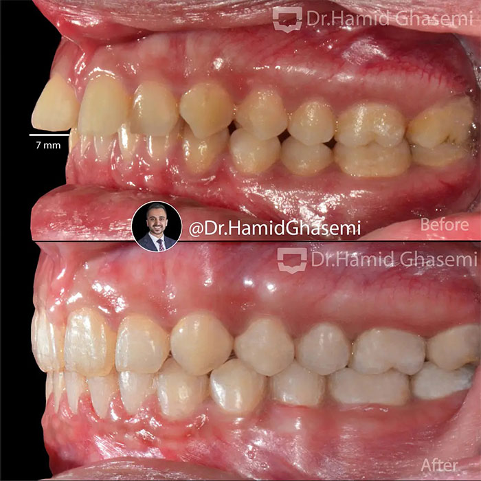 حورا-کبیری-3