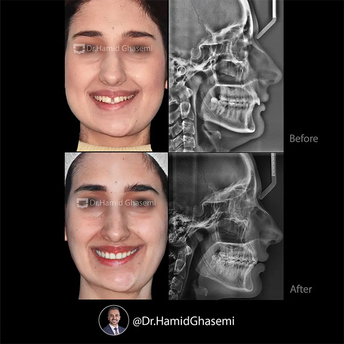 حورا-کبیری-4