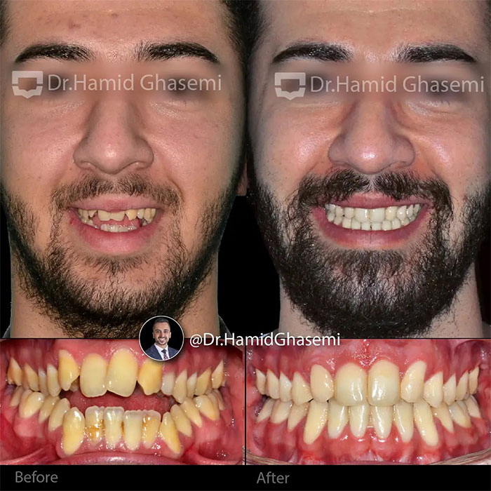 نمونه درمان ارتودنسی M.97_1321