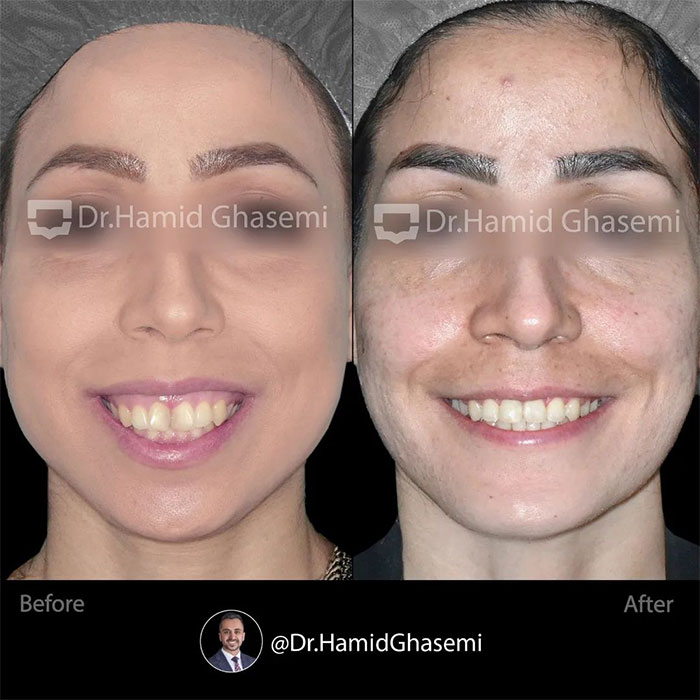 نمونه درمان ارتودنسی M.97_1351