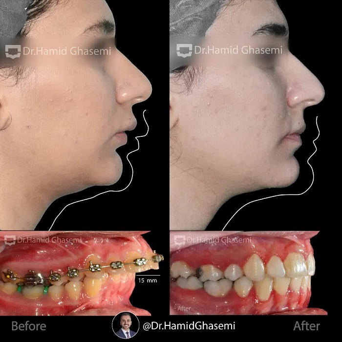 نمونه درمان ارتودنسی M.99_1764