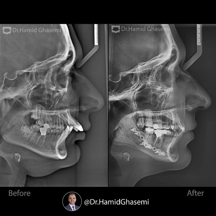 ستاره حمیدی2