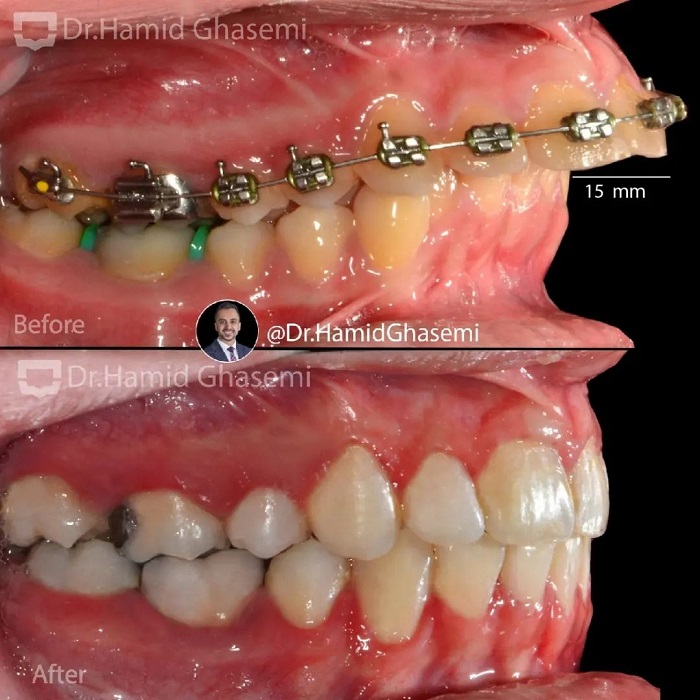 ستاره حمیدی3