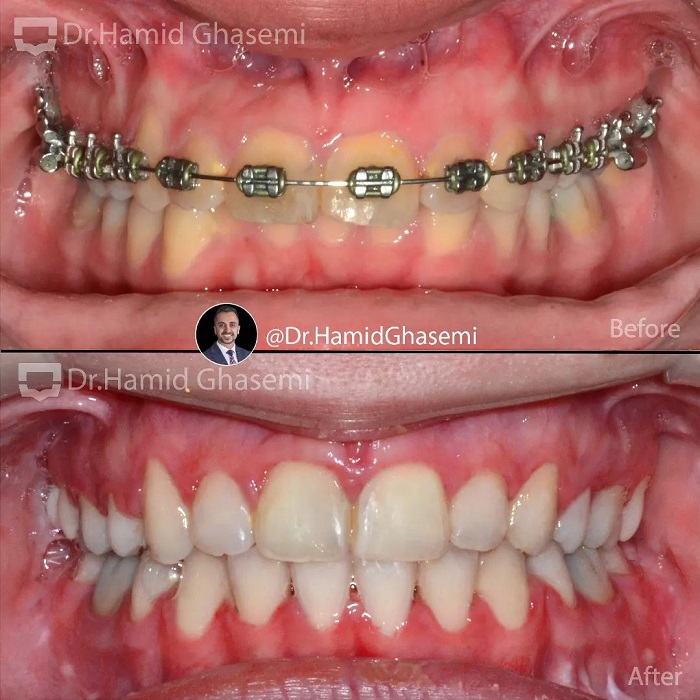 ستاره حمیدی4