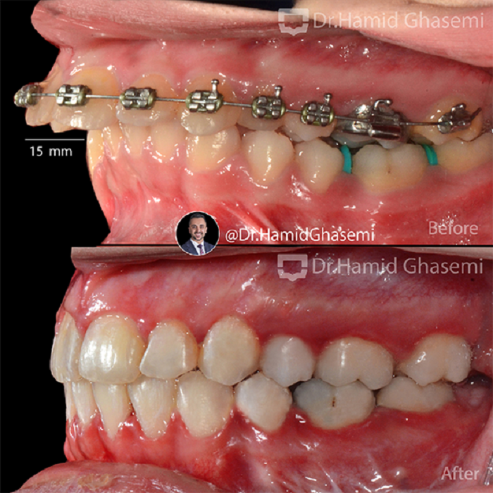 ستاره حمیدی5