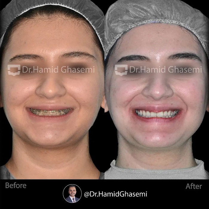 ستاره حمیدی6