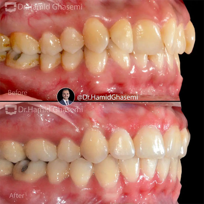 سمیه-محمدی-2