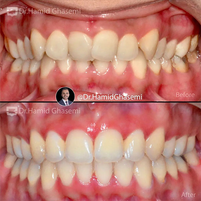 سمیه-محمدی-3