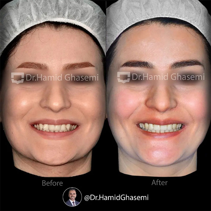 سمیه-محمدی-4