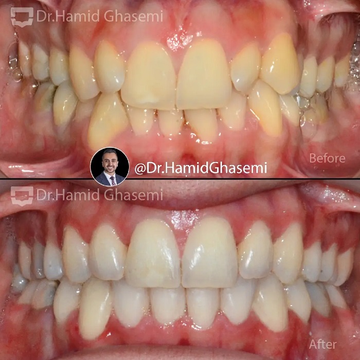 فاطمه انصاری (2)