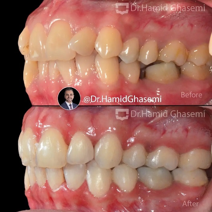 فاطمه انصاری (3)