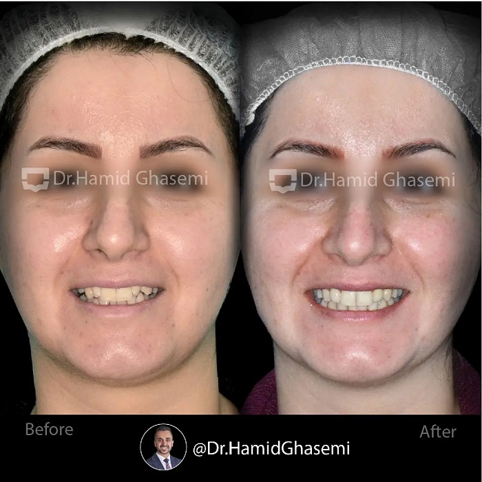 فاطمه انصاری (4)