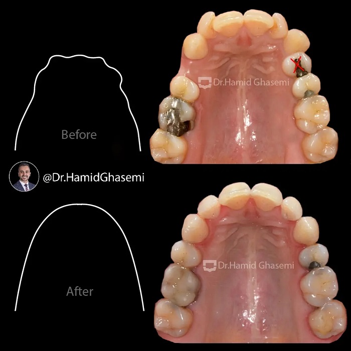 فاطمه انصاری (5)