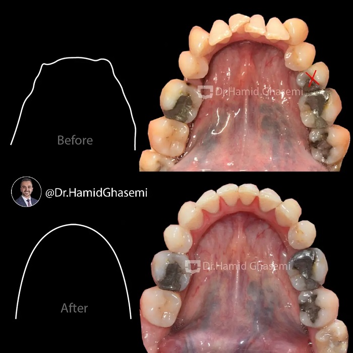 فاطمه انصاری (6)