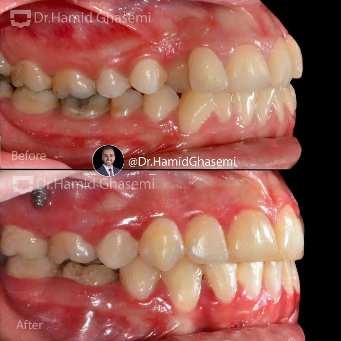 فاطمه بازی2