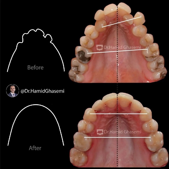 فاطمه بازی4
