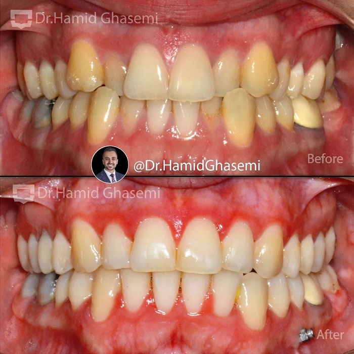 نمونه درمان ارتودنسی M.97_1398