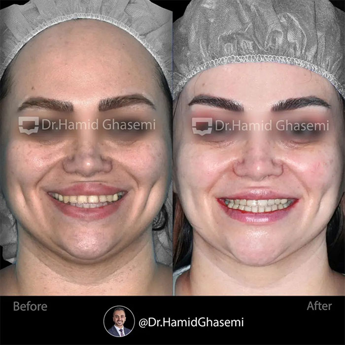 نمونه درمان ارتودنسی M.96_1215