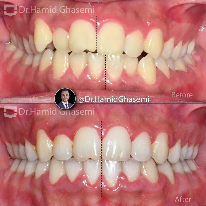 نمونه درمان ارتودنسی M.97_1336