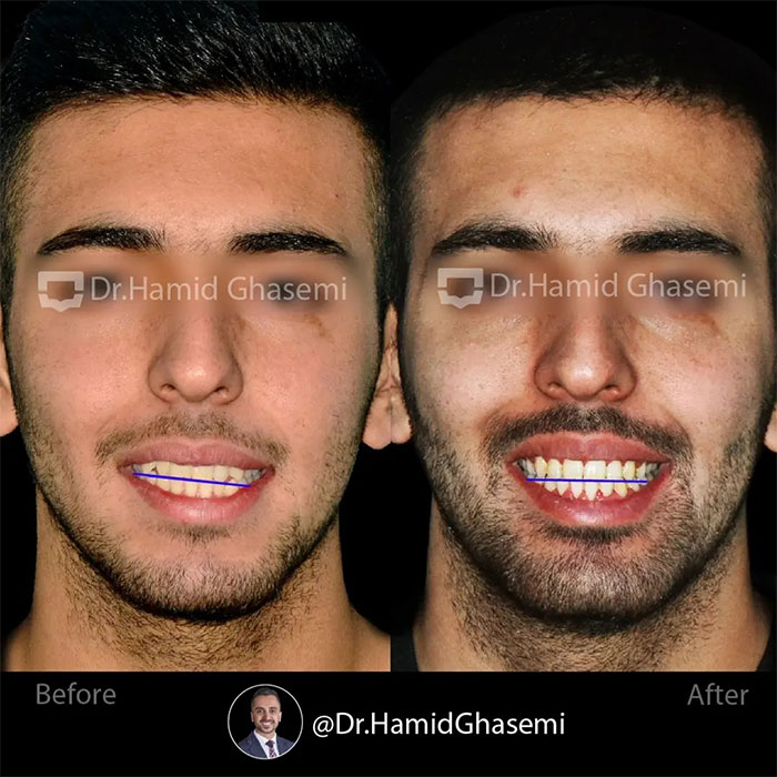 ماهان-بیات-2