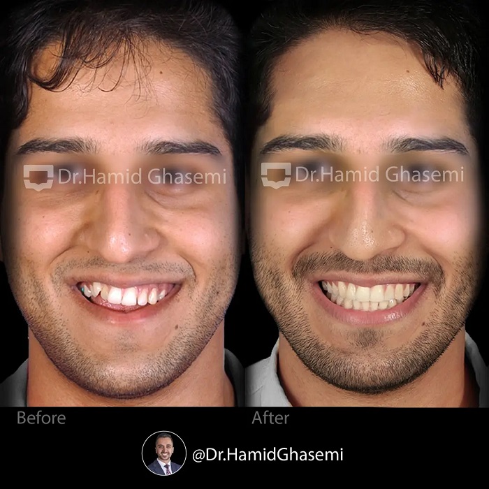 نمونه درمان ارتودنسی C.95_6789