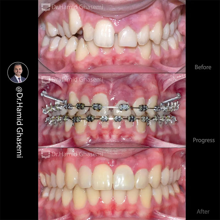 نمونه درمان ارتودنسی M.97_1216