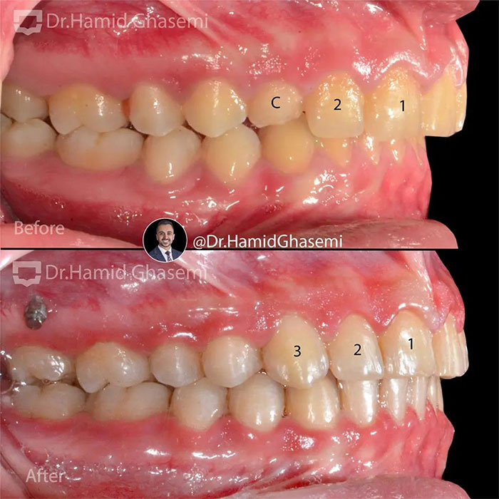 نمونه درمان ارتودنسی M.96_1207